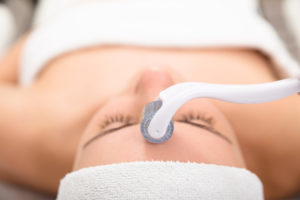 Microneedling 101